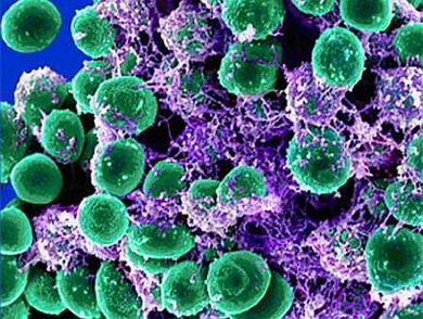 Genitourinary Pathogenen vu Prostatitis